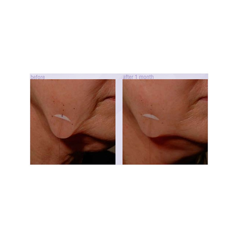 SPA Anti-Gravity Lifting Serum