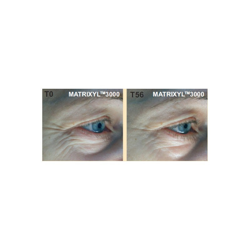 SPA Anti-Gravity Lifting Serum